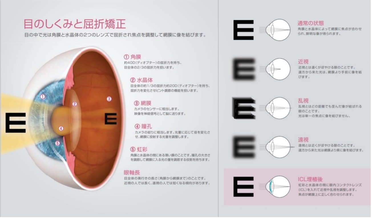 目の仕組みと屈折矯正