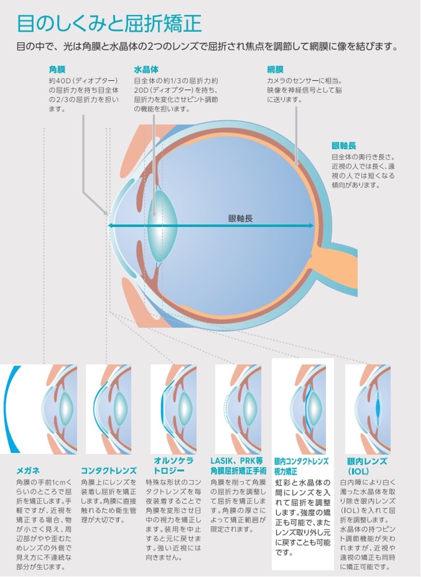 目の仕組みと屈折矯正