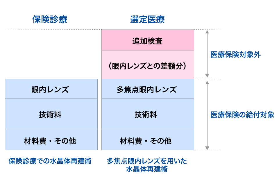 多焦点眼内レンズ　選定医療料金表